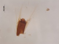 dytiscidae leg2