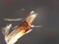 Chironomidae leg2
